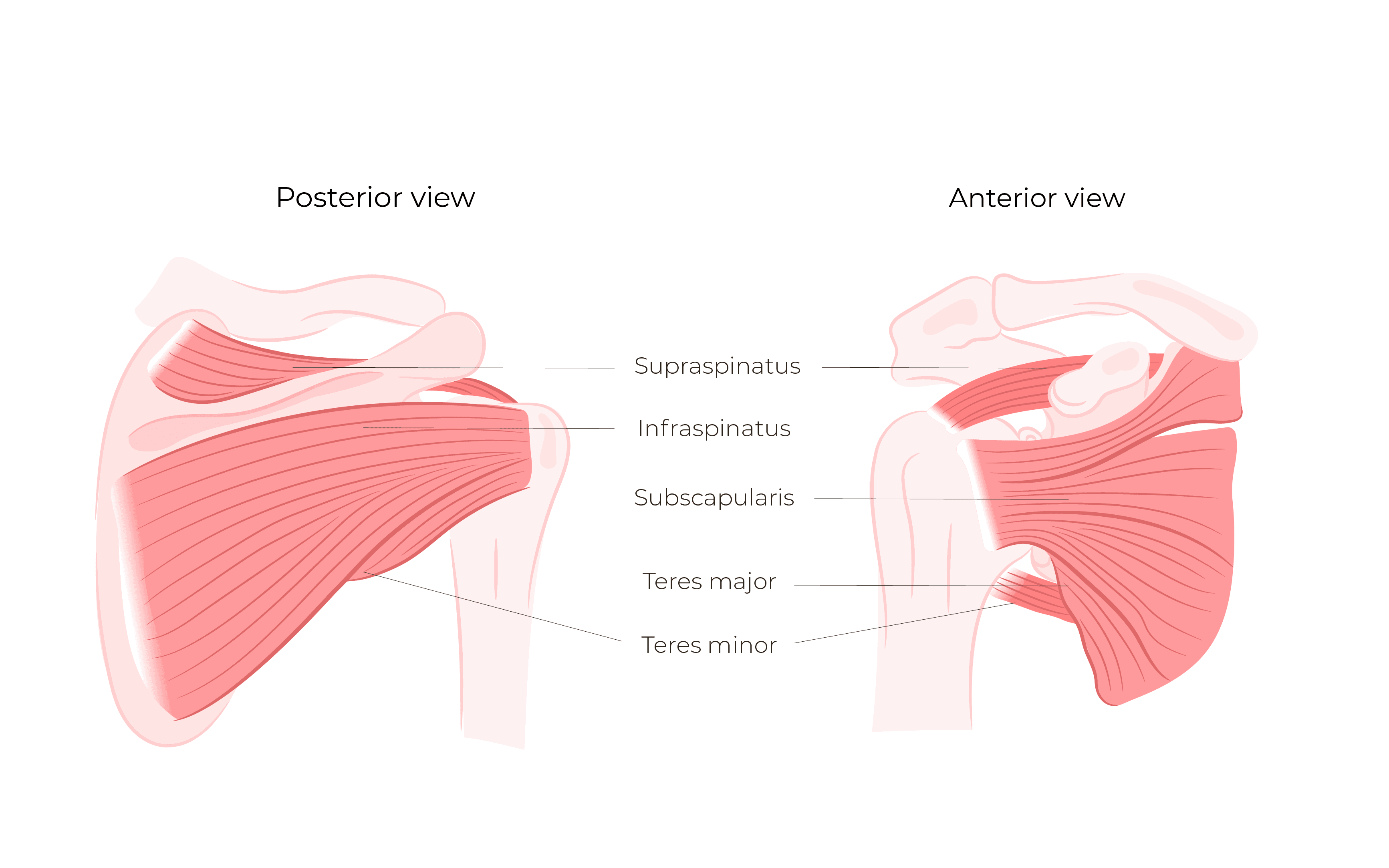rotator cuff tear