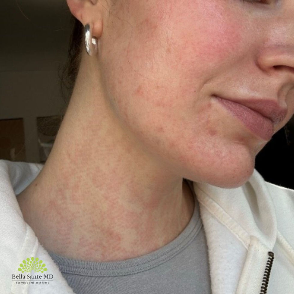 before morpheus8 saskatoon