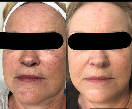 ipl near me saskatoon